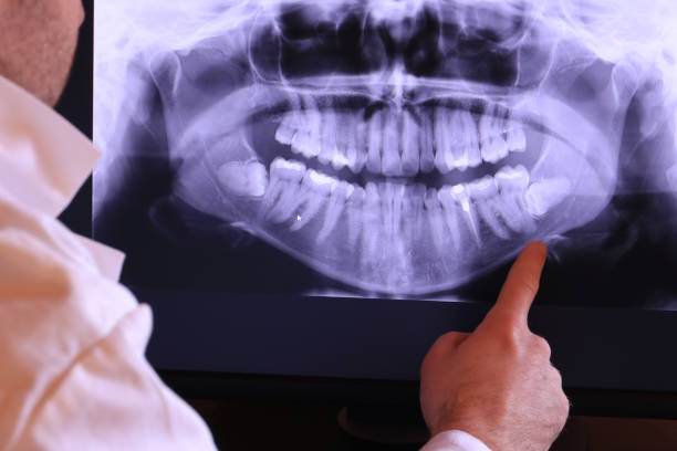Best Urgent Care for Lost Fillings or Crowns in Topeka, KS