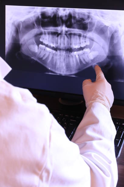 Best Emergency Dental Care for Broken or Chipped Teeth in Topeka, KS