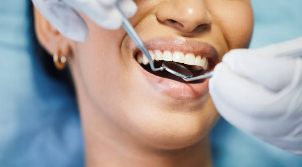 Best Emergency Treatment for Dental Infections or Abscesses in Topeka, KS