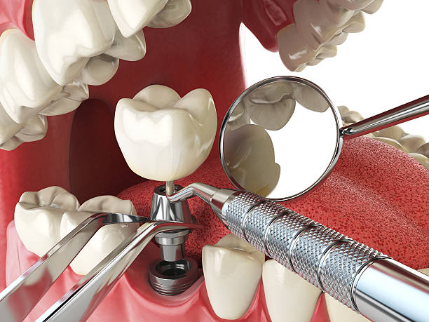 Best Weekend Emergency Dentist in Topeka, KS